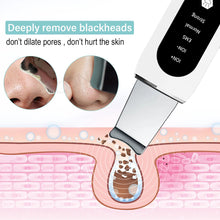 Load image into Gallery viewer, ClearSkin Ultrasonic Scrubber
